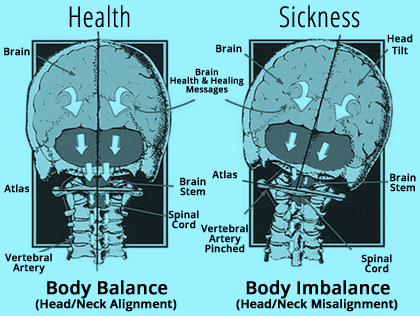 Advanced Upper Cervical